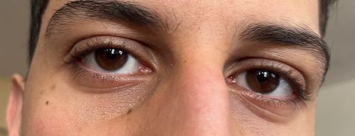 8 Ekim Dünya Görme Gününde Görme Sıkıntıları Hakkında Bilgi